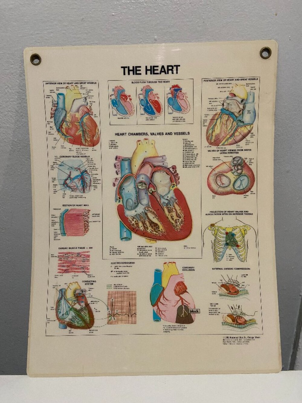 Laminated 1987 Anatomical Chart Co. THE HEART Chart Poster University Illinois